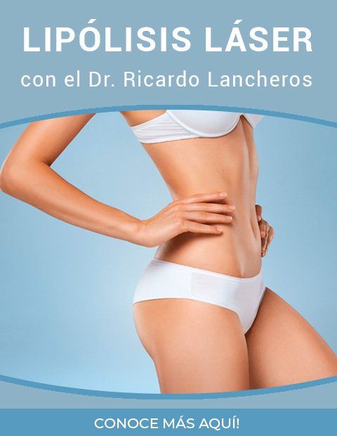 ricrado-lancheros-mobile