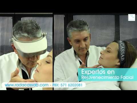 spot alejandro rada